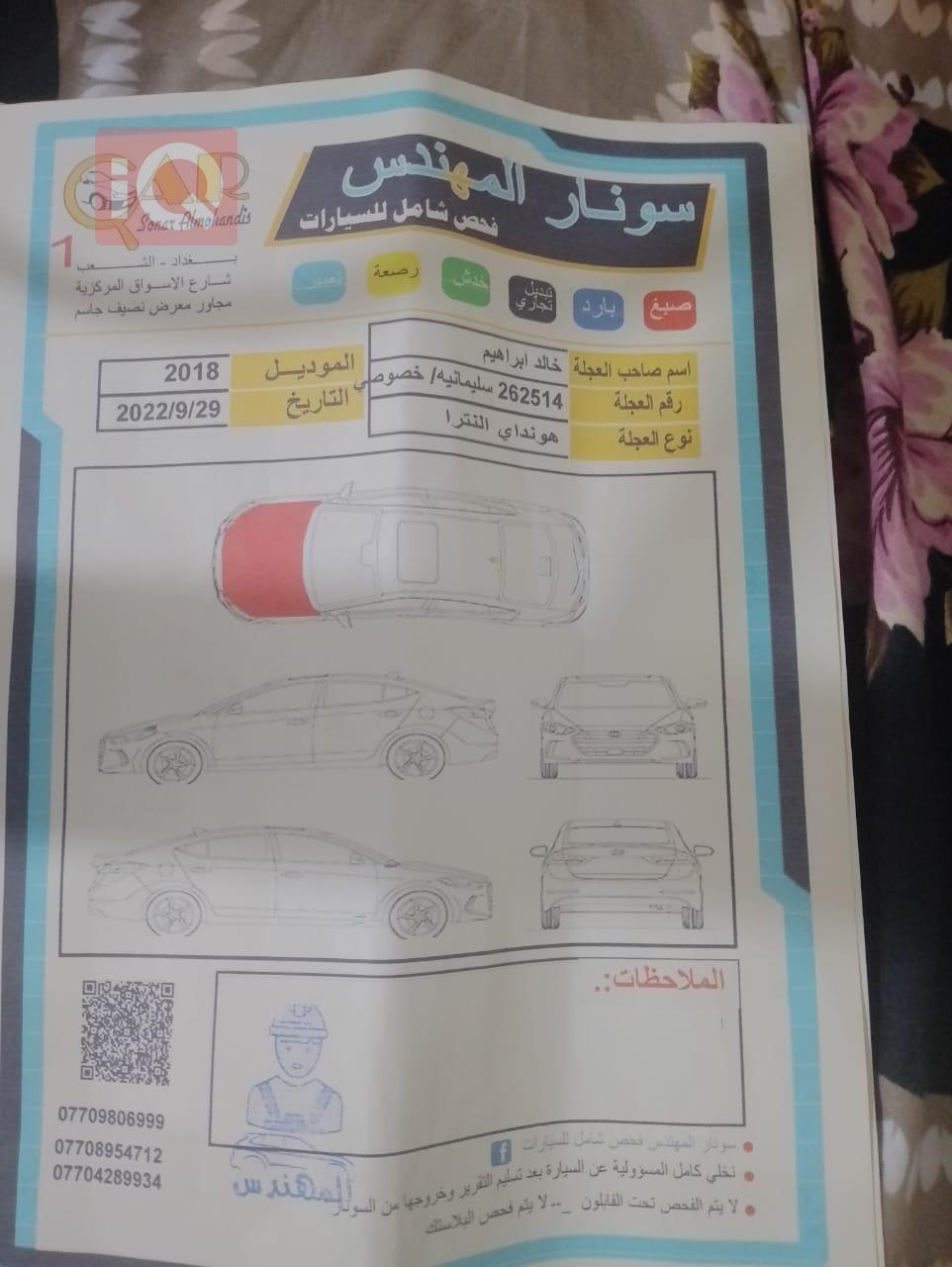 هيونداي النترا